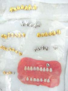 チベット歯医者２